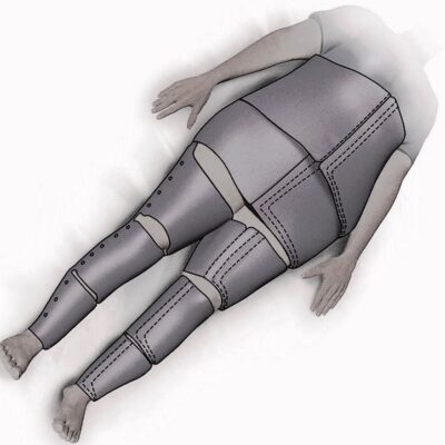 Non-pneumatic Anti-Shock Garment (NASG)