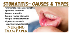 Types of stomatitis, stomatitis meaning, aphthous, herpetic, recurrent aphthous, candidal, ulcerative, viral, & denture stomatitis treatment