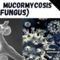 what is Mucormycotic black fungus