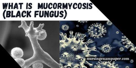 what is Mucormycotic black fungus