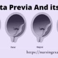 Placenta previa its types causes and management