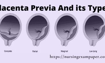 Placenta previa its types causes and management