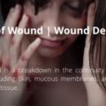 Types of Wound | Wound Definition basics of skin integrity, causes, severity, and cleanliness