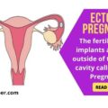 ectopic pregnancy, symptoms