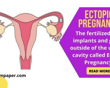 ectopic pregnancy, symptoms