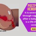 Postpartum Hemorrhage