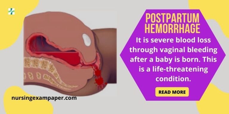 Postpartum Hemorrhage