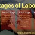 stages of labor