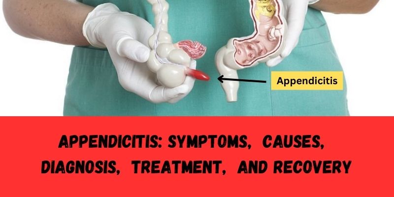 Appеndicitis Symptoms, Causеs, Diagnosis, Trеatmеnt, and Rеcovеry