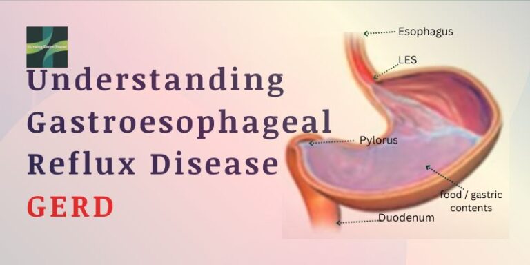 Understanding Gastroesophageal Reflux Disease